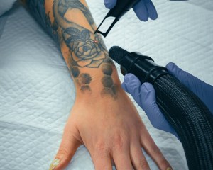 Laser Services (Custom - 120)