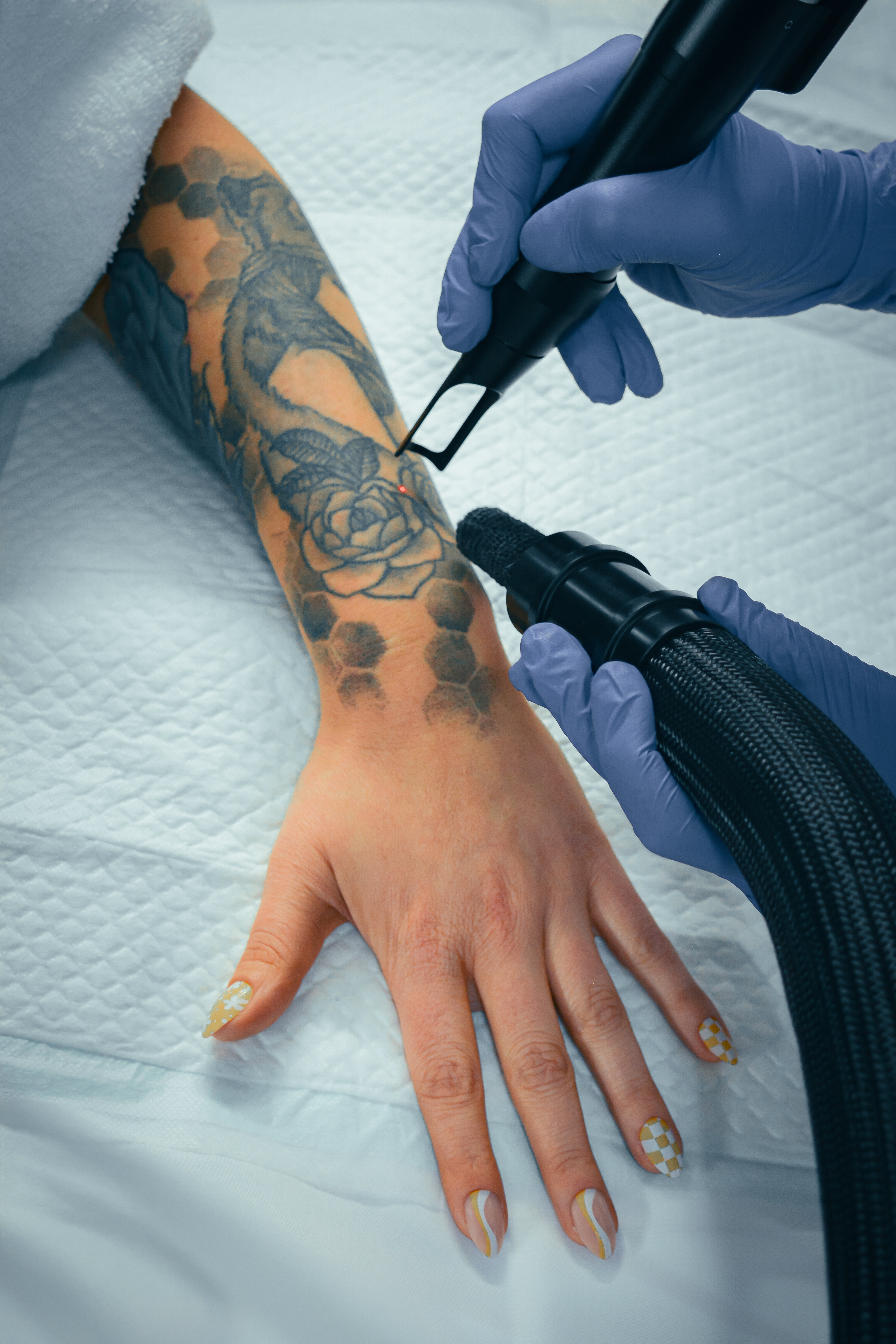 Laser Services (Custom - 120) - Image 1